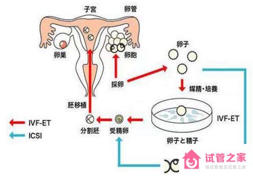 多囊做試管嬰兒多少費用為患者帶來曙光