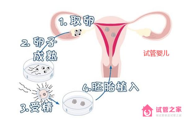 三*試管費(fèi)用明細(xì)和胚胎篩查費(fèi)用