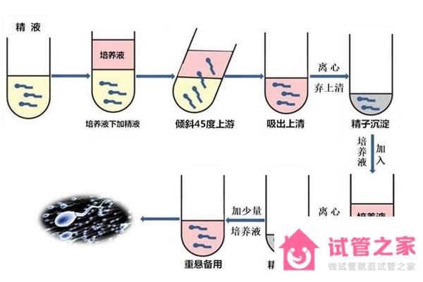 什么是XY精子分離術(shù)？第三*試管和XY精子分離術(shù)的區(qū)別