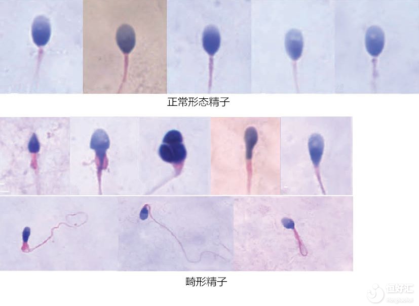 做試管嬰兒前，先看看你的精子情況怎么樣