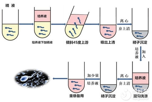 試管嬰兒會變胖加速衰老？最新辟謠來了