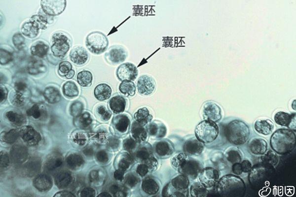 5ba囊胚移植幾天著床可測分情況，9天肚子不舒服還有希望