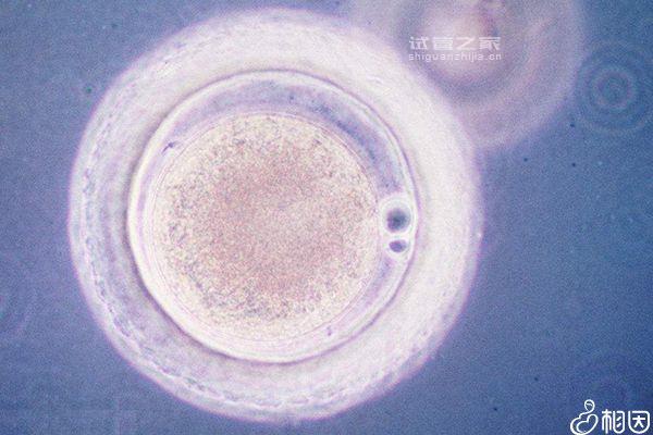 快收藏！5cc囊胚解凍移植后什么時(shí)間著床、注意事項(xiàng)來了