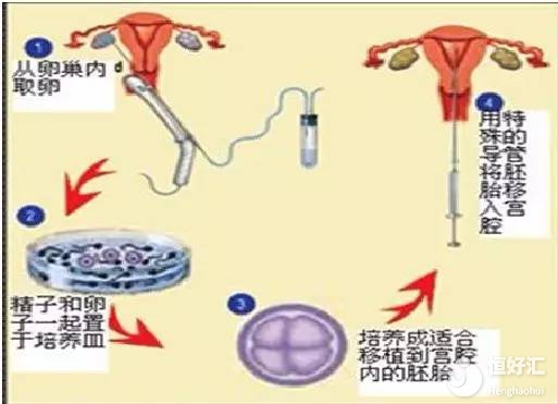 做試管嬰兒想提高懷孕機(jī)會？這些條件你要先具備
