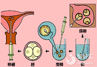 做試管精子和*子不能在體外受精？說出來你別不信