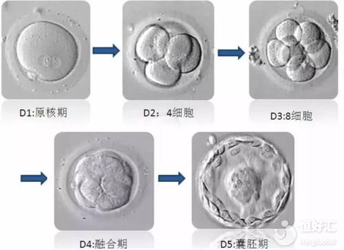 試管嬰兒胚胎等級(jí)越高，成功率就越高嗎？