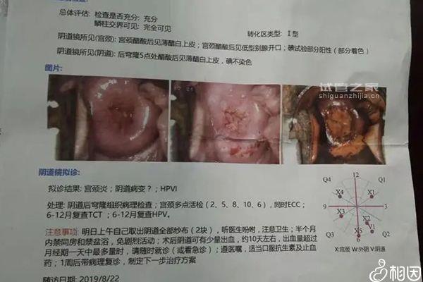 降調(diào)第十三天出血了可不正常！這些解決措施一定要早知