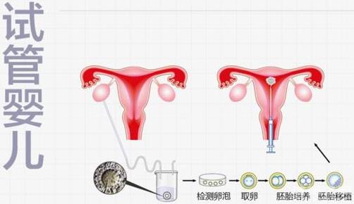 三*試管大概費(fèi)用多少如何省錢