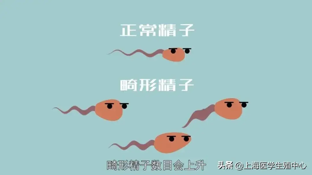 精子畸形是胎兒畸形的罪魁禍首嗎？