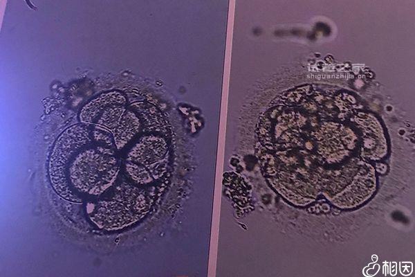 6細(xì)胞1級(jí)胚胎解凍移植成功率看人，質(zhì)量是否合格是關(guān)鍵