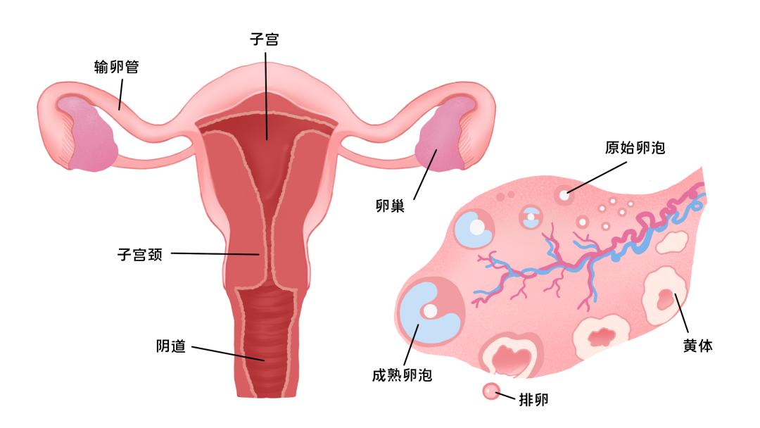 子宮內(nèi)膜異位癥為何會導(dǎo)致不孕？