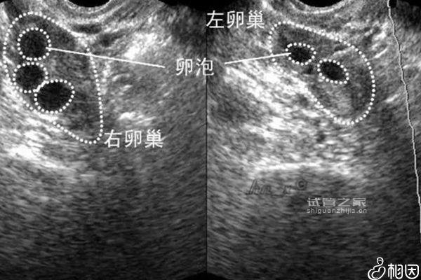 別管5個基礎(chǔ)*泡能取多少了，先看看最多可以促幾個再說