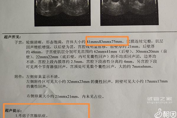 誰說14個(gè)基礎(chǔ)*泡促不起來幾個(gè)，先看看選的方案適合不