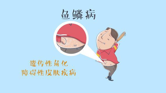 魚鱗病該不該生小孩？早發(fā)現(xiàn)早治療