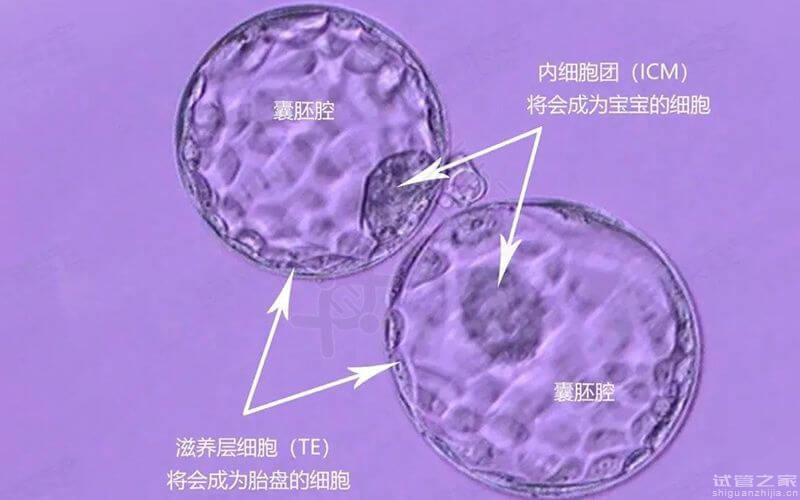 鮮胚、凍胚、囊胚優(yōu)點(diǎn)對(duì)比，移植哪個(gè)成功率高一目了然