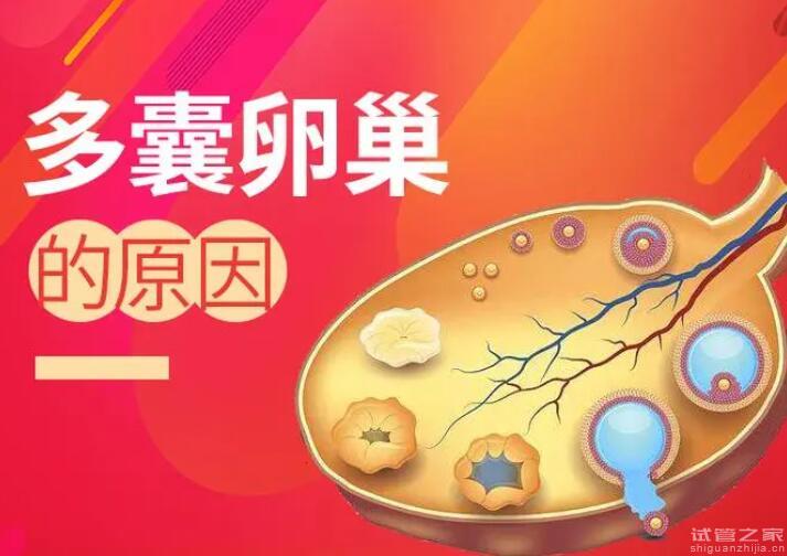 多囊卵巢能自然懷上孩子嗎？不行可以試管嗎？