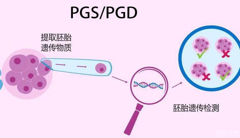 魚鱗病可以做試管嬰兒排除嗎多少錢？