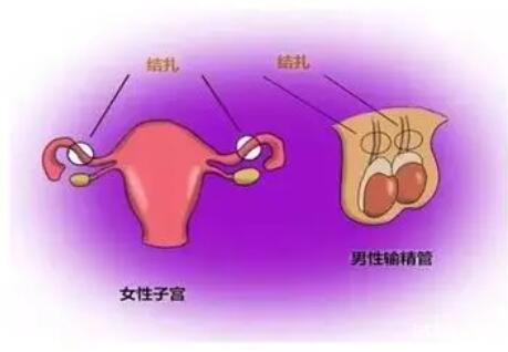 輸卵管結(jié)扎了還會自然懷孕嗎？做試管懷孕要多少錢？