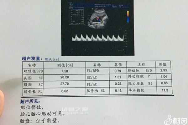 長(zhǎng)沙產(chǎn)檢假規(guī)定2023，休幾天、是否含158天產(chǎn)假里要早知