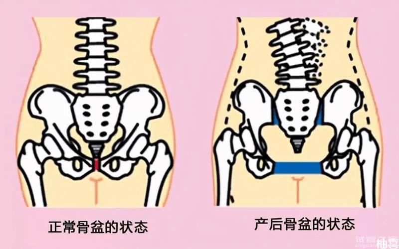 骨盆修復(fù)價格影響因素多，手術(shù)、藥物收費(fèi)各不相同