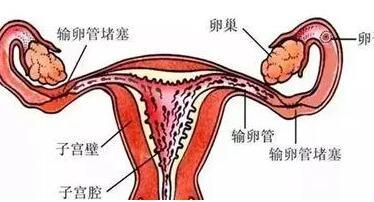 輸卵管結(jié)核能自然受孕嗎費(fèi)用一般多少？