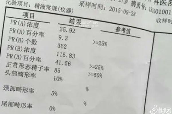 精子前向運(yùn)動(dòng)26%是否是輕度弱精分析，不育得這樣做