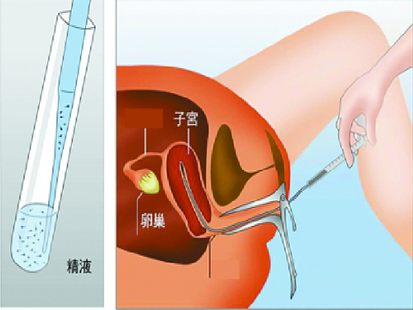 美國與國內(nèi)試管嬰兒醫(yī)生對比，哪個(gè)好看完就知道