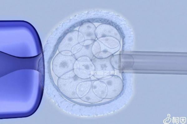 一文看懂子宮憩室囊胚能不能移植成功，出血與否這里都有