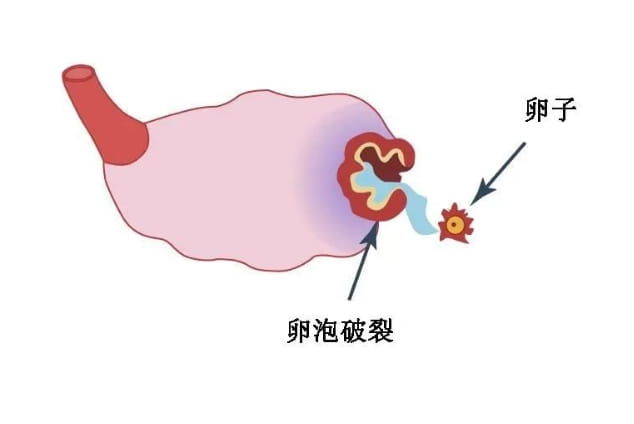 這三類人群，可以考慮一個促排周期取兩次卵！-試管嬰兒網