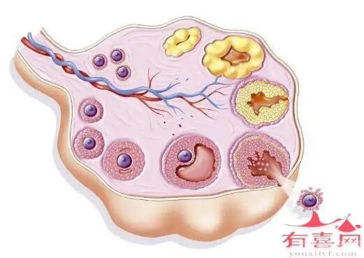 試管促排卵詳細(xì)過(guò)程是怎樣的