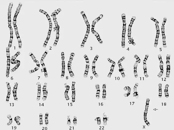 3代試管篩查出的胚胎染色體存在缺陷能移植嗎？