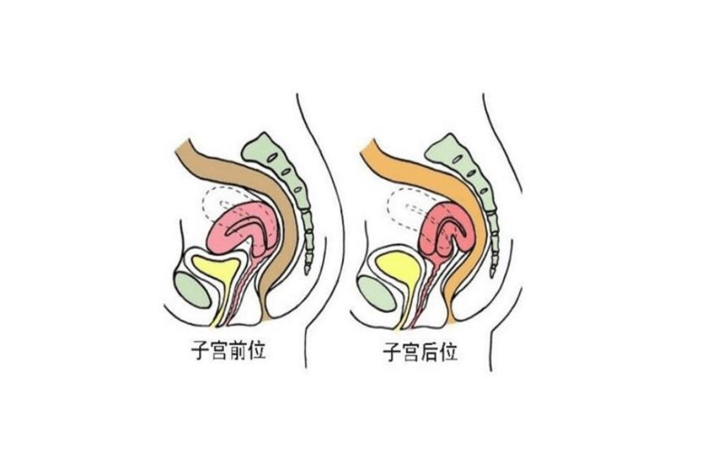 子宮后位痛經(jīng)不可小瞧，教你按摩方法輕松緩解