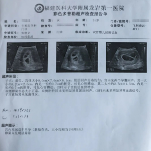 龍巖市第一例試管嬰兒成功受孕