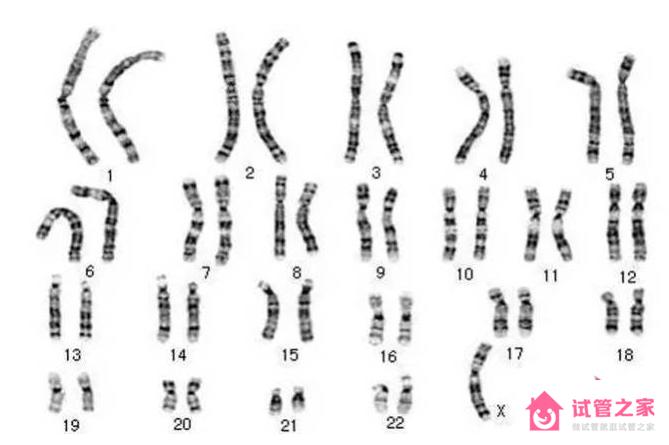 染色體核型分析怎么檢查