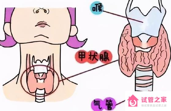 甲狀腺癌會遺傳給孩子嗎