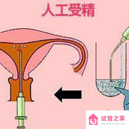 想知道人工授精成功率有多大嗎