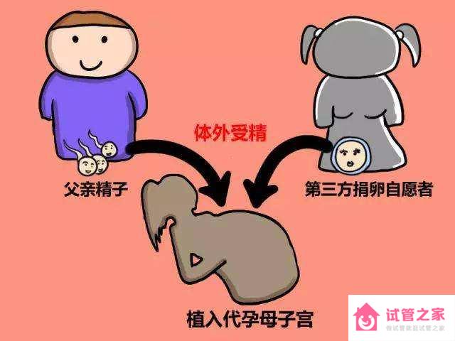 哪些人需要輔助生殖