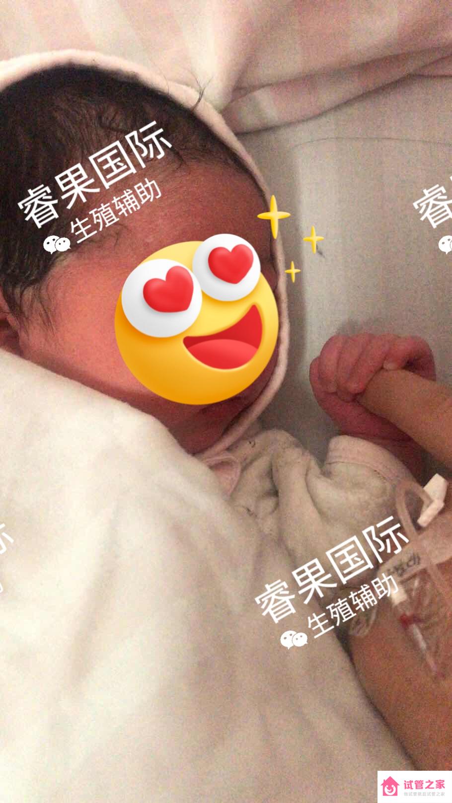 *巢早衰做試管嬰兒，我成功抱上了我的小王子！