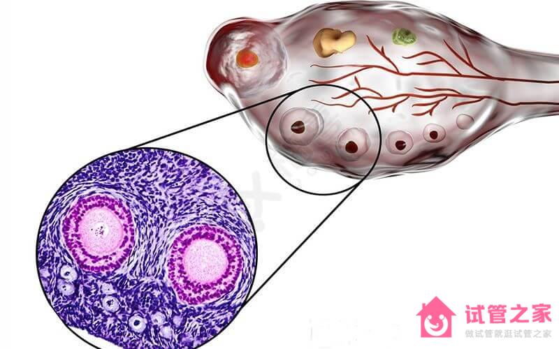 2022試管嬰兒知識索引：多囊*巢*泡，取*效果首要原則