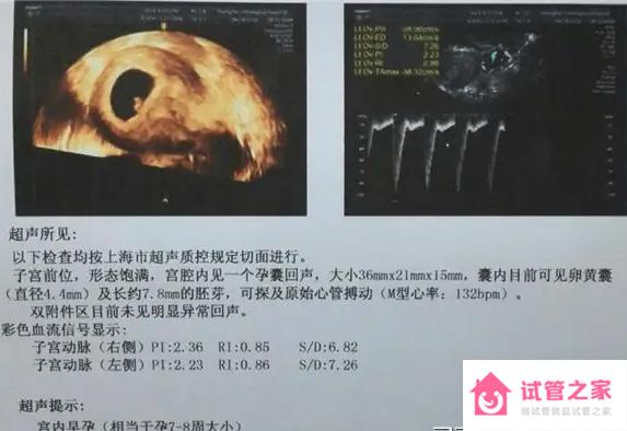 試管移植胎心可以很直接的反應(yīng)胎兒的情況