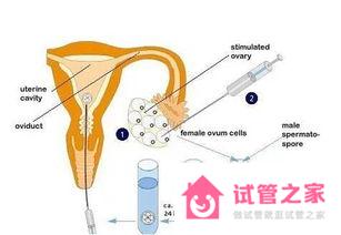 泰國試管嬰兒價(jià)格大概多少錢