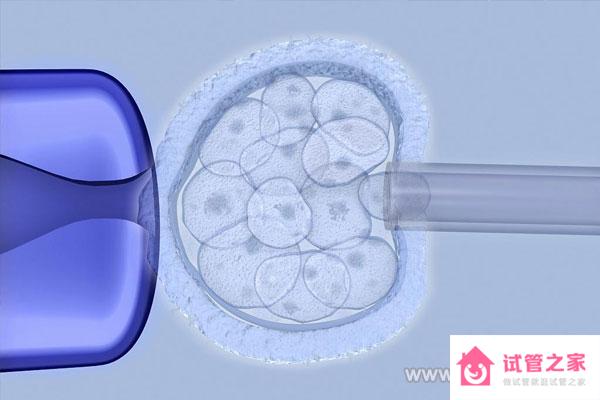 【做試管嬰兒的條件】國內(nèi)外做試管嬰兒條件，試管嬰兒前的準(zhǔn)備 ...