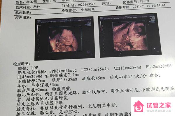 福州四維彩超私立醫(yī)院排名整理，2023費(fèi)用、預(yù)約一文說清