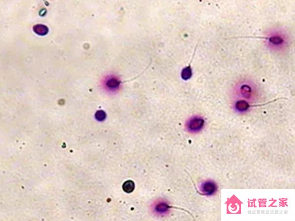 精子dna碎片化檢測和染色體體檢有什么區(qū)別？