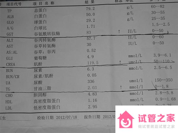 老公婚檢發(fā)現(xiàn)肌酐高到90會影響備孕嗎？