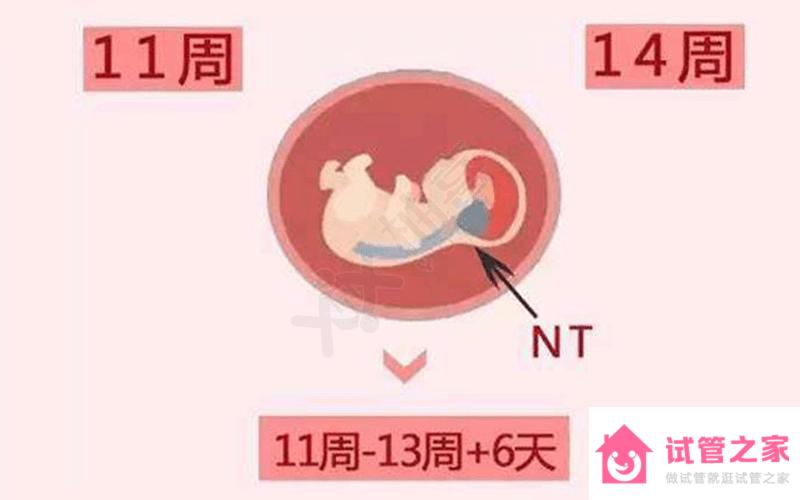 nt檢查最佳時間要記牢！超過14周再做可就沒有意義了