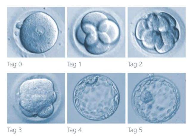 試管嬰兒胚胎等級8c質(zhì)量怎么樣?