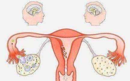 從月經(jīng)看*巢，出現(xiàn)這3種情況就要注意了！