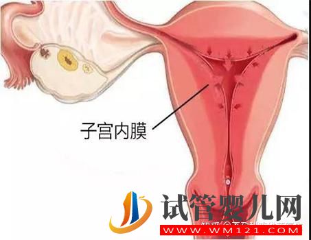 子宮內(nèi)膜異位癥有這4種類型,難怪癥狀不一樣