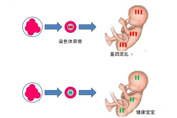 PGS對(duì)高齡孕婦習(xí)慣性流產(chǎn)、反復(fù)試管失敗有幫助嗎？